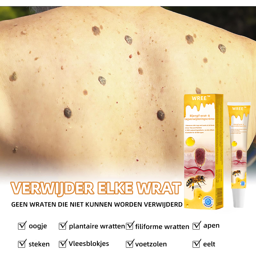 🌷WREE™ Bijengif wrat- en tagverwijderingscrème (👨‍⚕Geschikt voor alle huidtypes)🐝(🔥Weekendaanbieding)